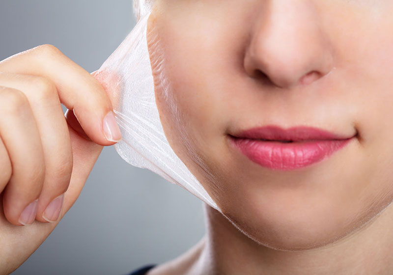 Chemical Peel – Skin Resurfacing Facial