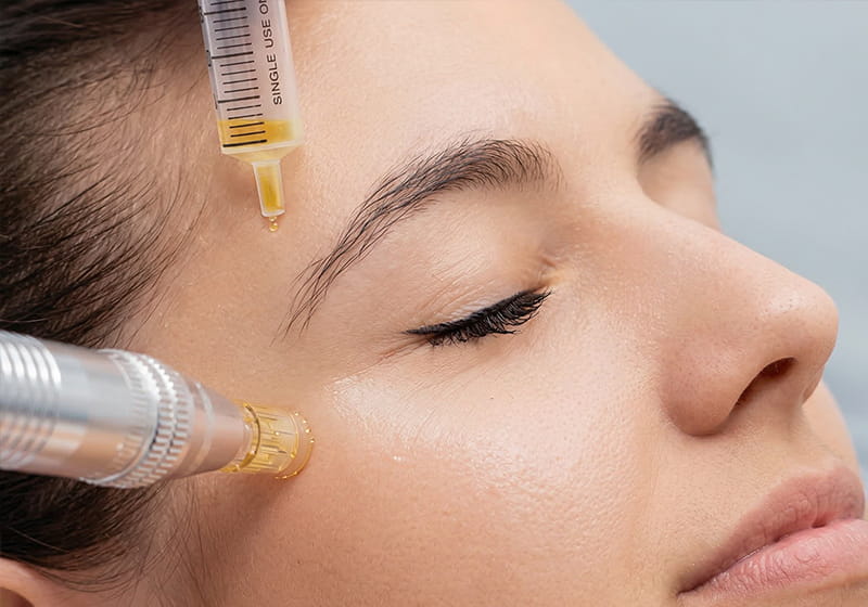 Glow Renewal PRP Facial